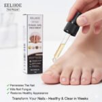 TRATAMIENTO REPARADOR PARA UÑAS CON HONGOS FORMULA EFICAZ EELHOE 30ML