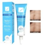 CREMA FACIAL Y CORPORAL PARA CICATRICES, SUAVIZA, APLANA LAS CICATRICES, REDUCE ENROJECIMIENTO Y ALIVIA PICAZON KELO COTE 15G