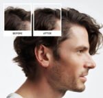 TRATAMIENTO PARA EL CRECIMIENTO DEL CABELLO PARA HOMBRES NATURAL PROGRESIVO NIOXIN PRO